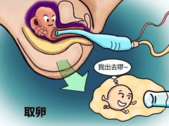 试管婴儿取卵全过程