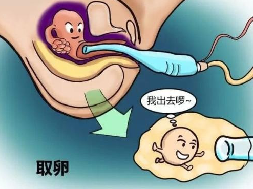 试管婴儿