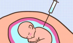 试管婴儿取卵后出现腹水肚子很疼
