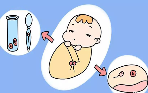 试管婴儿
